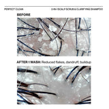 Scalp Replenishment Set